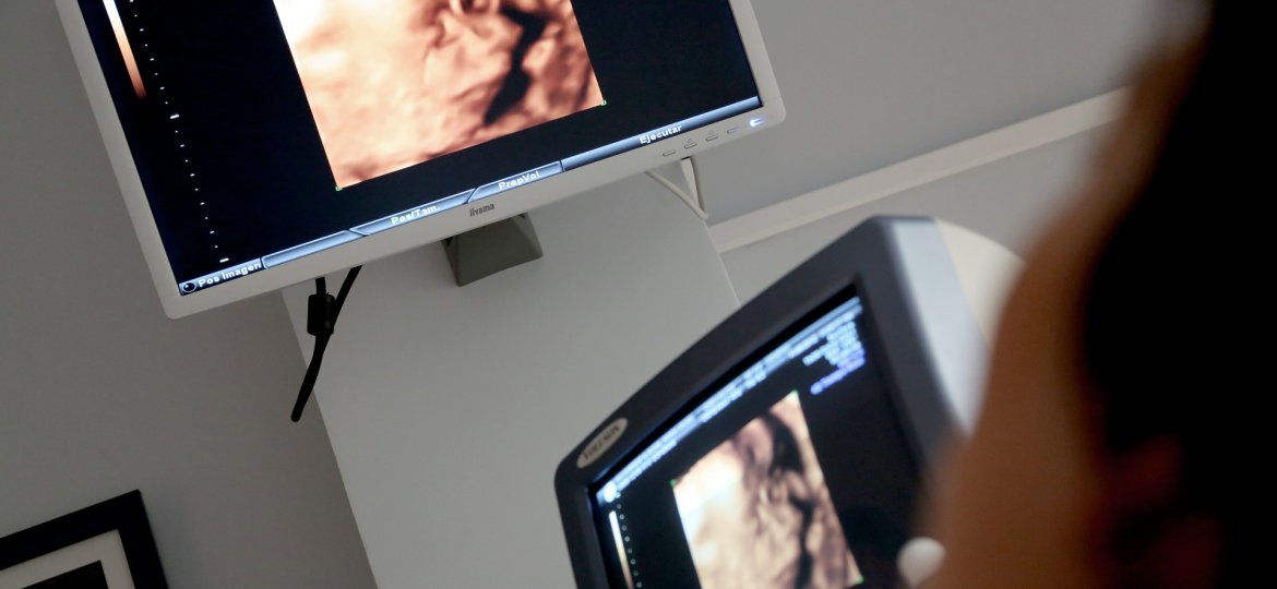 monitor-470511_1920