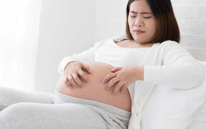 Kolestaza u trudnoći