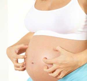 Kolestaza u trudnoći