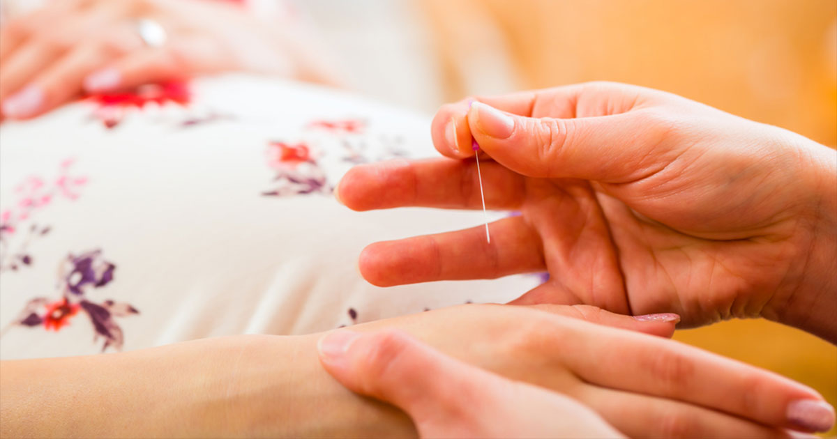Akupunktura u trudnoći