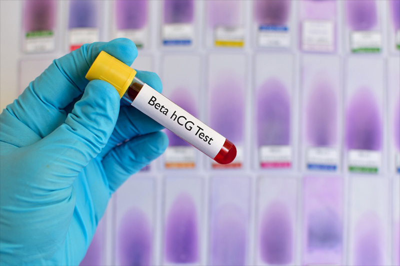 Beta HCG test trudnoće