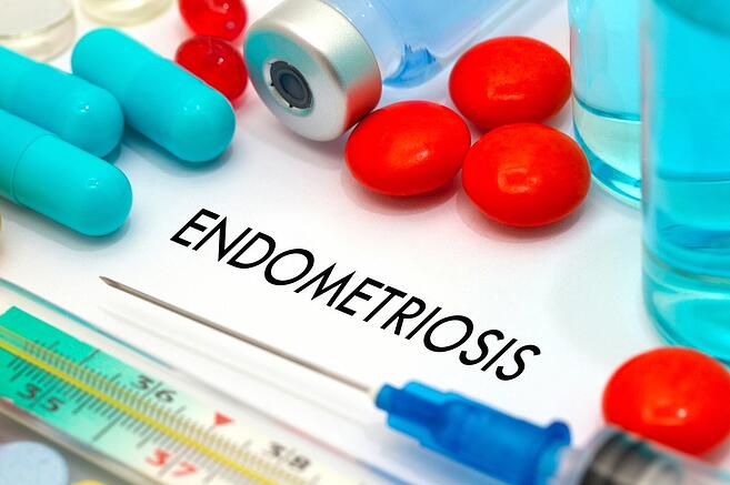 Lječenje endometrioze