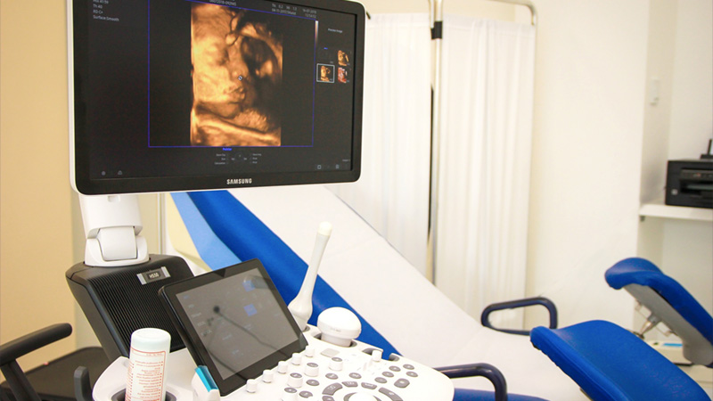 Ginekološki ultrazvuk