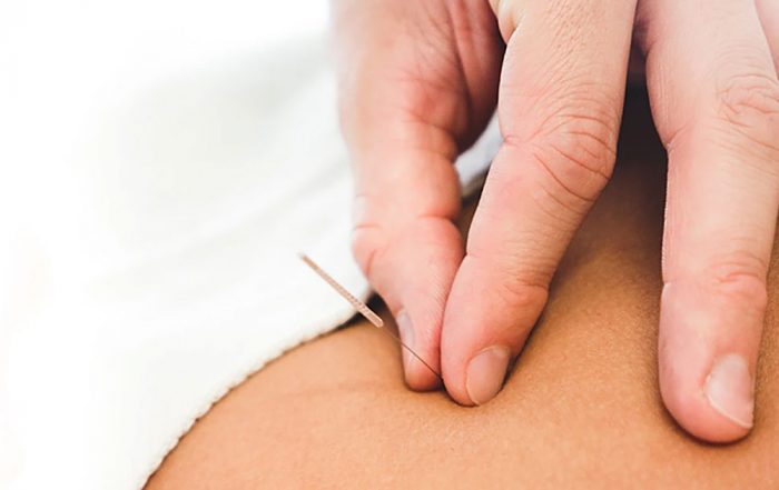 Uloga akupunkture u homeostazi općeg i ginekološkog zdravlja