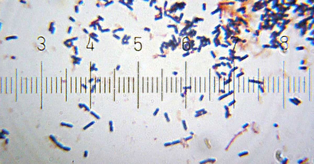 Endobiom – analiza mikrobioma maternice