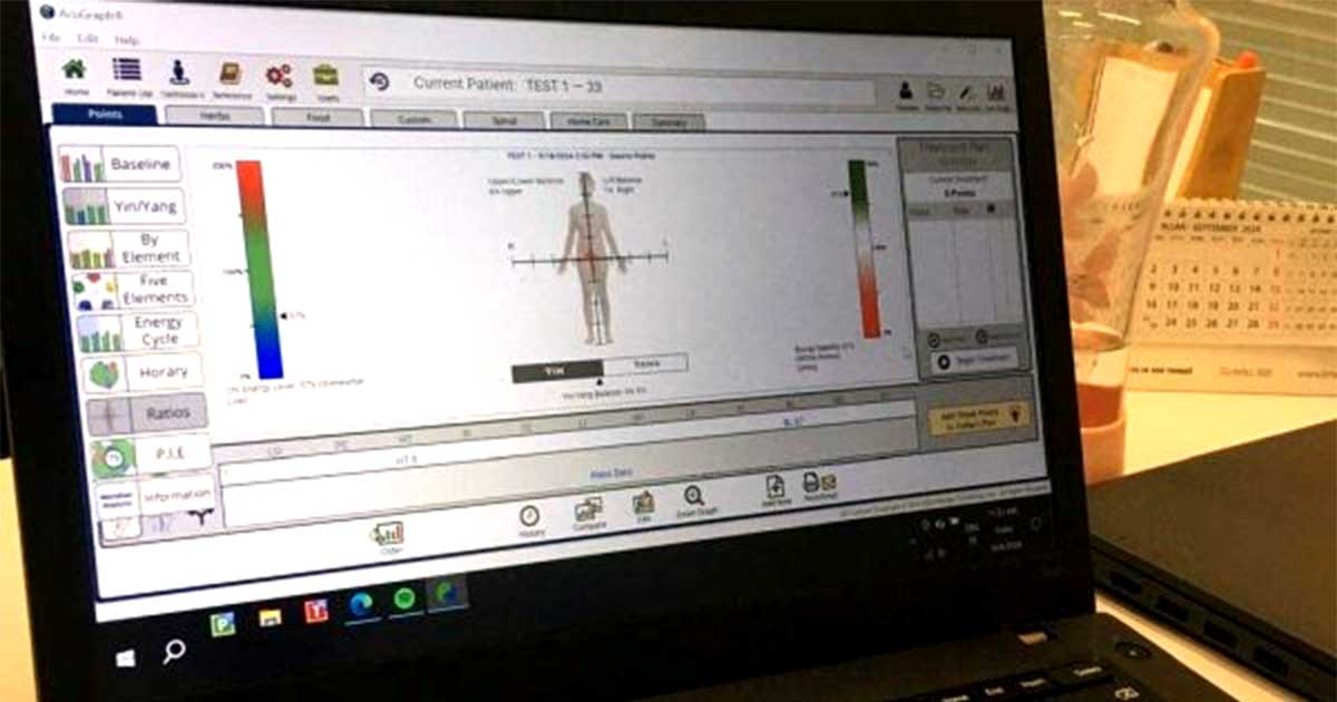 AcuGraph Monitor