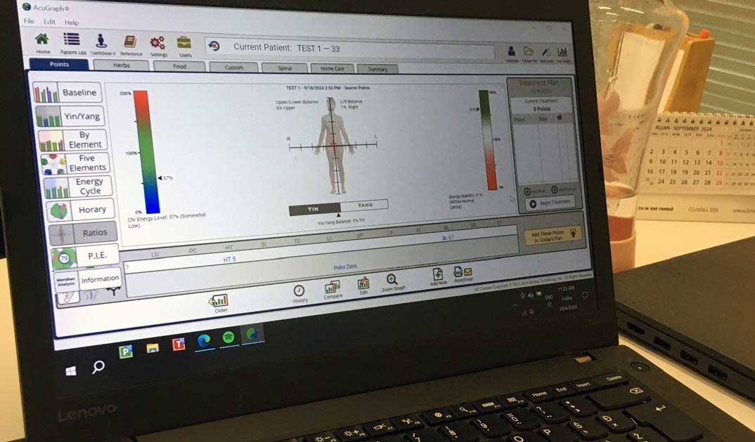 AcuGraph monitor